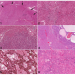 Comparative Histomorphological Review of Rat and Human Hepatocellular Proliferative Lesions