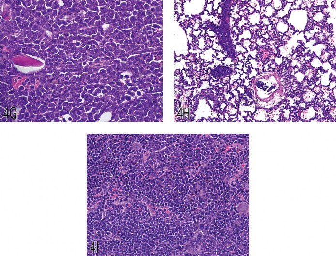 Fig 4. (A) Typical skin lesion from a Tg.AC mouse (squamous papilloma). (B) Skin lesion from a Tg.AC mouse (squamous papilloma). (C) Malignant squamous cell transformation adjacent to a papilloma in a Tg.AC mouse. (D) Odontoma with tooth elements from a Tg.AC mouse. (E) Atypical odontoma from the oral cavity of a Tg.AC mouse. (F) Erythroleukemia in the bone marrow of a Tg.AC mouse. (G) Erythroleukemia in the bone marrow of a Tg.AC mouse (higher magnification). (H) Erythroleukemia in the lung of a Tg.AC mouse. Pulmonary capillaries are highly cellular. (I) Splenic extramedullary hematopoiesis in a Tg.AC mouse. Megakaryocytic, myeloid, and erythroid cells are present within the hypercellular splenic parenchyma.