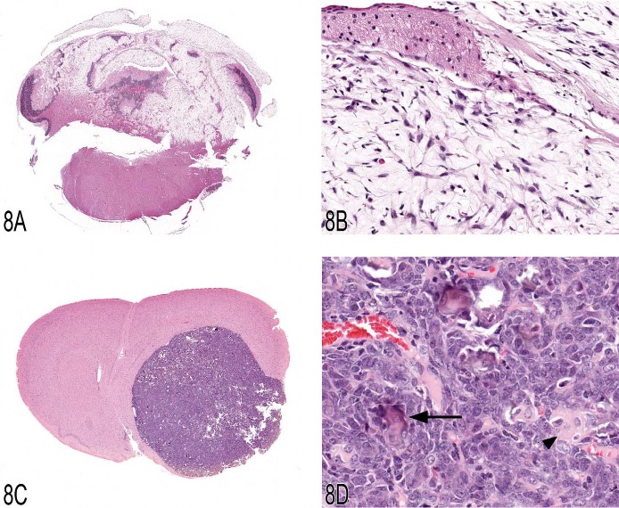 Fig 8. (A, B) B6C3F1 mouse, cerebellum, low and high magnification, respectively. The cerebellum is invaded and destroyed by a paucicellular meningeal neoplasm composed of spindle to stellate-shaped cells surrounded by a myxoid matrix (myxoid malignant meningioma). (C, D) Fischer 344 rat, forebrain, low and high magnification, respectively. The forebrain is markedly compressed by a well-circumscribed mass composed of small lobules frequently containing small foci of hyalinized collagen and mineralization consistent with psammoma bodies (psammomatous meningioma). 