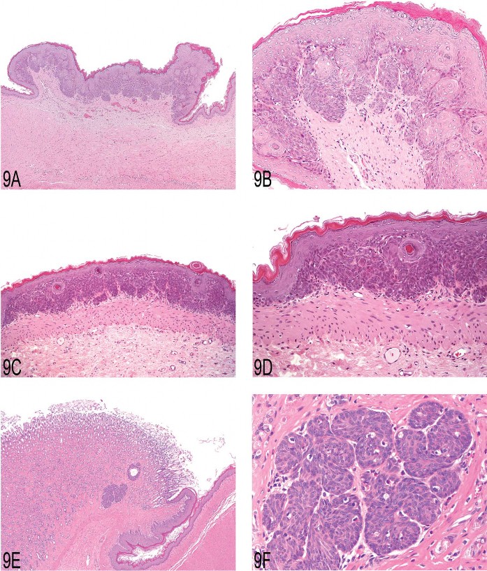 Fig 9. (A) Focal epithelial proliferation in the forestomach of a two-year-old female Wistar rat. Note elevation from the adjacent unaffected epithelium mimicking a “sessile papilloma.” (B) Higher magnification showing prominent development of rete pegs, built up mainly by basal and prickle cells. (C) Focal basal cell hyperplasia in the forestomach of a two-year-old female Wistar rat. Note proliferation of basal cell layers and orderly structure of stratum granulosum and corneum. (D) Higher magnification of (C) showing proliferation of basal cells forming tightly packed papillary projections. (E) Proliferation of basal cells in the gastric glandular mucosa of a two-year-old male Wistar rat. Note proximity to the limiting ridge. (F) Higher magnification of (E) demonstrating the basal cell character of this epithelial proliferation.