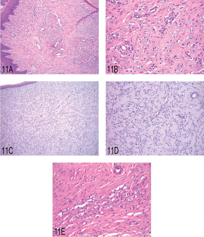 Fig 11. (A, B) Low and high magnification, respectively, of granular cell hyperplasia in the uterine cervix of a rat. (C, D) Low and high magnification, respectively, of a benign granular cell tumor in the uterine cervix of a rat. (E) Granular cell aggregate in the uterus of a rat. 