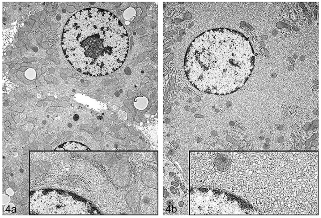 FIGURE 4.—(a and b) Transmission electron microscope photograph of control (left panel, 4a) and treated (right panel, 4b) rat hepatocytes showing hypertrophy after treatment with a COX inhibitor. Treated hepatocytes are characterized by increased amount of sER (sER proliferation) that crowds out and peripherally compresses other organelles in the cell. Inset shows a higher magnification of the cytosol immediately adjacent to the nucleus. (Note: Figures 2a, 3, and 4 were previously published in Toxicologic Pathology, 38: 776–95, 2010, and used by kind permission of Sage Publishing and courtesy of NTP. Figure 4 courtesy of Dr Katsuhiko Yoshizawa [with permission].)