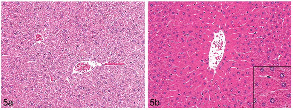 FIGURE 5.— (a and b) H&E stained low-power photomicrograph of Wistar rat liver showing control (left panel 5a) and treated (right panel 5b) livers from animals treated with a peroxisome proliferating agent (phenoxy herbicide) characterized by centrilobular hepatocyte hypertrophy and intensely eosinophilic cytoplasm. Inset: oversharpened area of image to demonstrate fine cytoplasmic granularity.