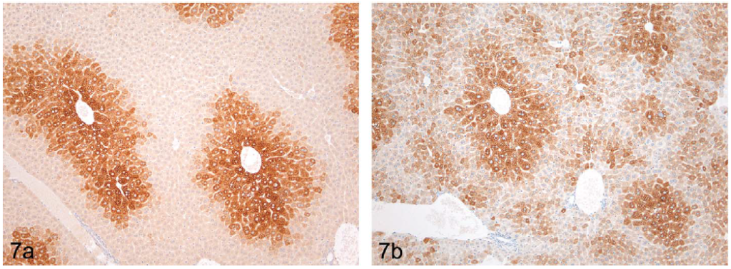 FIGURE 7.—(a) Immunolocalization of CYP 1A1 in untreated CD1 mouse liver demonstrating centrilobular expression of the enzyme using immunocytochemistry. (b) Immunolocalization of CYP 3A2 in untreated CD1 mouse liver showing a predominantly centrilobular localization of the enzyme but with random cells throughout the lobule showing expression of the enzyme.