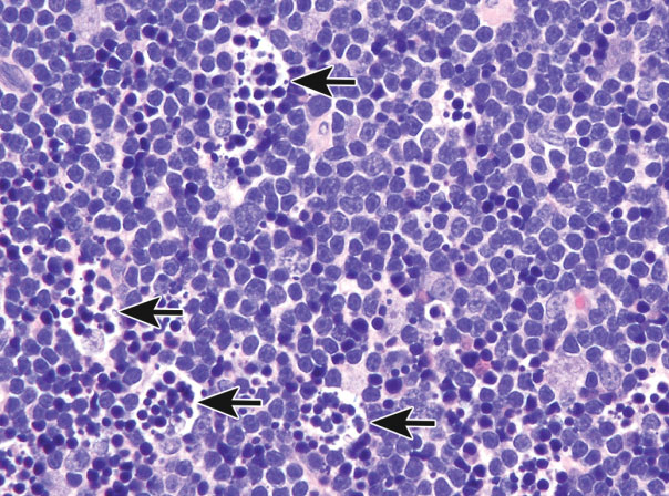 Figure 11. Tingible body macrophages (arrows) with engulfed apoptotic bodies in the thymus cortex of a male 3-month-old Sprague-Dawley rat dosed with 1 mg/kg dexamethasone and necropsied 24 hr later. There are also scattered free apoptotic bodies (small, dark hyperchromatic) within the cortical parenchyma that have not yet been engulfed.
