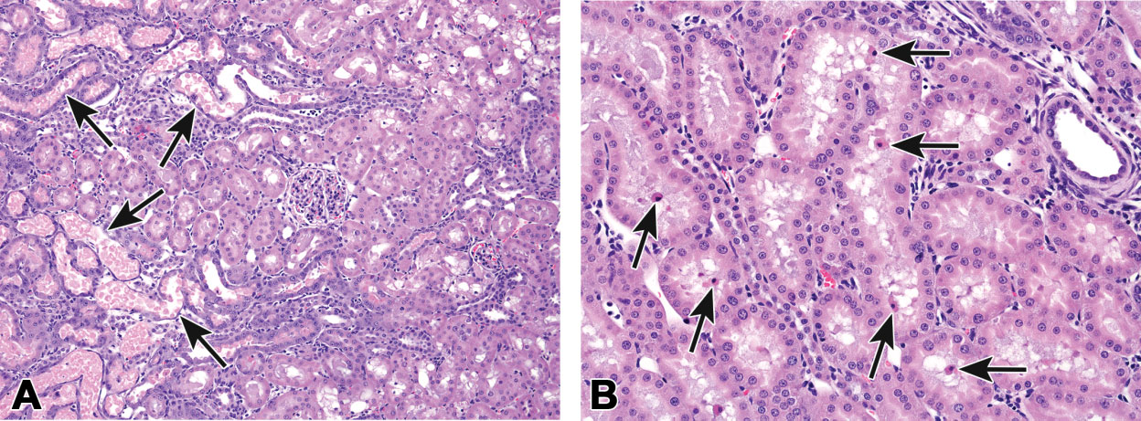 Figure 18. Examples of necrosis and apoptosis of kidney tubule epithelial cells. Scattered renal tubules show necrosis of the epithelium; each cluster of tubules most likely represents a single convoluted tubule (A; arrows). This would have a diagnosis of renal tubular necrosis. In (B), there are tubules with occasional desquamated epithelial cells that have an apoptotic morphology (arrows) but that could also be mixed with necrotic cells. In this case, one could use either apoptosis or necrosis if there were confidence in the type of cell death or the combination term apoptosis/single cell necrosis could be used. Images courtesy of Dr. John Seely.