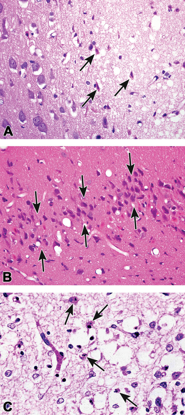 Figure 19. Examples of classic red dead neurons and apoptotic neurons. Classic red dead neurons (arrows) in the cortex of a rat exposed to carbonyl sulfide via inhalation (A; Morgan et al. 2004). “Red dead” pyramidal neurons (outlined by arrows) in the hippocampus from a mouse exposed to an excitotoxic amino acid (kainic acid; B). According to recent reports in the literature, these cells are likely undergoing a mixture of apoptosis and necrosis (Wang et al. 2005). Cells morphologically similar to apoptotic neurons (arrows; C). Images (A) and (B) courtesy of Dr. Jim Morrison. Image (C) courtesy of Dr. Roland Auer.