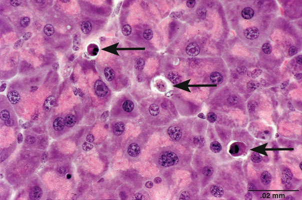 Figure 2. Apoptosis of exocrine pancreatic cells with cytoplasmic and nuclear condensation and nuclear fragmentation (arrows). Image courtesy of National Toxicology Program (NTP) archives.
