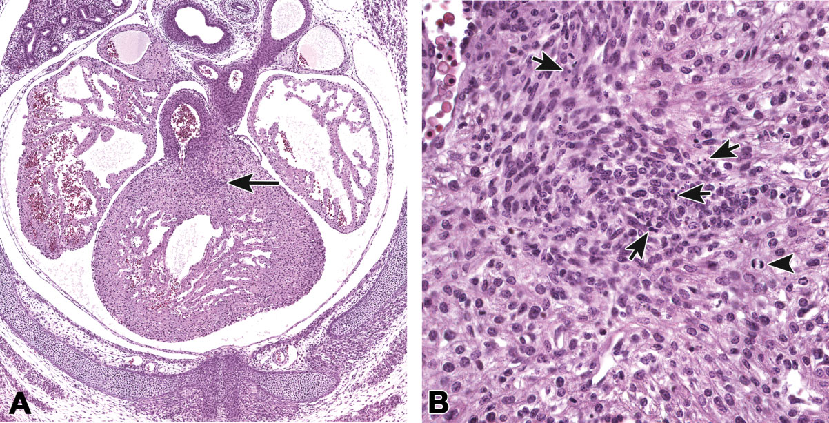 Figure 3. Apoptosis in the outflow tract cushions of the embryonic day 13.5 mouse heart. A transverse section (A) through the developing heart demonstrates the newly formed conal septum (arrow) separating the 2 ventricular outlets, pulmonary trunk, and aorta. Foci of apoptotic cell debris (B, arrows) are found in the cushion tissue surrounding the newly formed conal septum. A mitotic cell (arrowhead) is also present. Previously published in Toxicologic Pathology; Savolainen, Foley, and Elmore (2009).