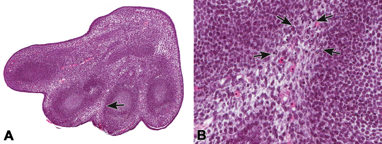 Figure 4. Apoptosis between digits in the developing mouse. Limb buds in the mouse embryo (A) have a webbed appearance with interdigital tissue that has not yet regressed (arrow). Higher magnification (B) shows scattered apoptotic cellular debris (outlined by arrows) in the interdigital tissue. Images courtesy of Julie Foley, National Institute of Environmental Health Science.