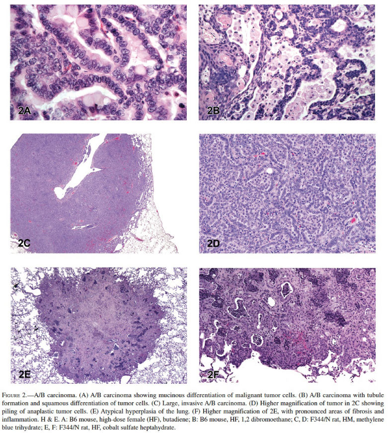 Follicular Epithelial Cell Hypertrophy Induced by Chronic Oral  Administration of 2,3,7,8-Tetrachlorodibenzo-p-Dioxin in Female Harlan  Sprague–Dawley Rats - Toxicologic Pathology