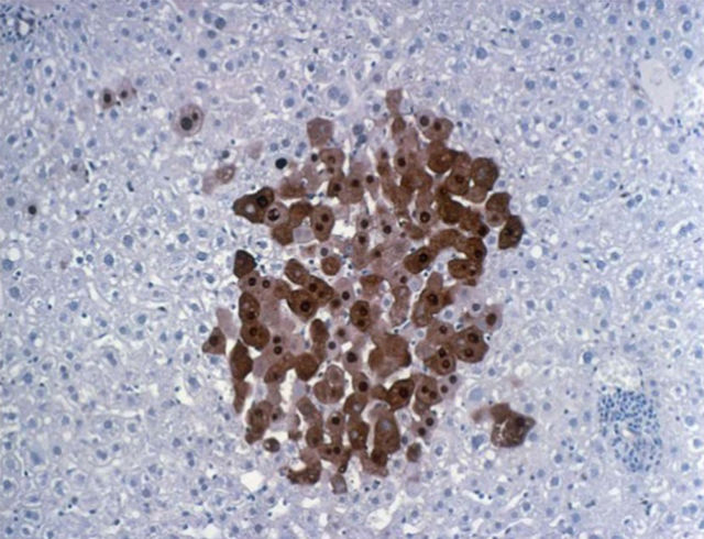 rat liver foci toxicologic pathology
