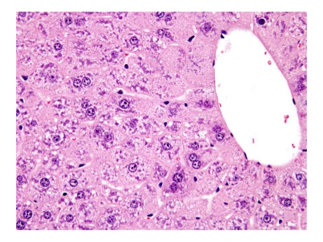 xenobiotic-induced-liver-pathology-9-638